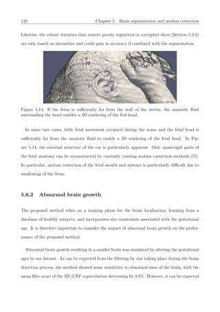110 Chapter 5. Brain segmentation and motion correction
Likewise, the robust statistics that remove poorly registered or corrupted slices (Section 5.3.2)
are only based on intensities and could gain in accuracy if combined with the segmentation.
Figure 5.14: If the fetus is suﬃciently far from the wall of the uterus, the amniotic ﬂuid
surrounding the head enables a 3D rendering of the feal head.
In some rare cases, little fetal movement occurred during the scans and the fetal head is
suﬃciently far from the amniotic ﬂuid to enable a 3D rendering of the fetal head. In Fig-
ure 5.14, the external structure of the ear is particularly apparent. Only quasi-rigid parts of
the fetal anatomy can be reconstructed by currently existing motion correction methods [75].
In particular, motion correction of the fetal mouth and airways is particularly diﬃcult due to
swallowing of the fetus.
5.6.2 Abnormal brain growth
The proposed method relies on a training phase for the brain localisation, learning from a
database of healthy subjects, and incorporates size constraints associated with the gestational
age. It is therefore important to consider the impact of abnormal brain growth on the perfor-
mance of the proposed method.
Abnormal brain growth resulting in a smaller brain was simulated by altering the gestational
ages in our dataset. As can be expected from the ﬁltering by size taking place during the brain
detection process, the method showed some sensitivity to abnormal sizes of the brain, with the
mean Dice score of the RF/CRF segmentation decreasing by 3.8%. However, it can be expected
 