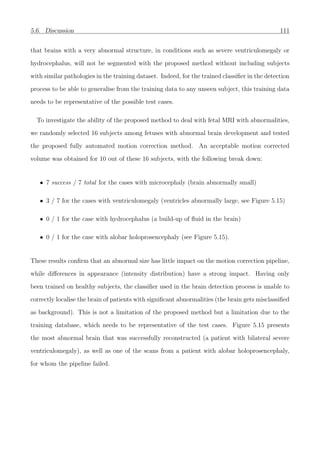 5.6. Discussion 111
that brains with a very abnormal structure, in conditions such as severe ventriculomegaly or
hydrocephalus, will not be segmented with the proposed method without including subjects
with similar pathologies in the training dataset. Indeed, for the trained classiﬁer in the detection
process to be able to generalise from the training data to any unseen subject, this training data
needs to be representative of the possible test cases.
To investigate the ability of the proposed method to deal with fetal MRI with abnormalities,
we randomly selected 16 subjects among fetuses with abnormal brain development and tested
the proposed fully automated motion correction method. An acceptable motion corrected
volume was obtained for 10 out of these 16 subjects, with the following break down:
• 7 success / 7 total for the cases with microcephaly (brain abnormally small)
• 3 / 7 for the cases with ventriculomegaly (ventricles abnormally large, see Figure 5.15)
• 0 / 1 for the case with hydrocephalus (a build-up of ﬂuid in the brain)
• 0 / 1 for the case with alobar holoprosencephaly (see Figure 5.15).
These results conﬁrm that an abnormal size has little impact on the motion correction pipeline,
while diﬀerences in appearance (intensity distribution) have a strong impact. Having only
been trained on healthy subjects, the classiﬁer used in the brain detection process is unable to
correctly localise the brain of patients with signiﬁcant abnormalities (the brain gets misclassiﬁed
as background). This is not a limitation of the proposed method but a limitation due to the
training database, which needs to be representative of the test cases. Figure 5.15 presents
the most abnormal brain that was successfully reconstructed (a patient with bilateral severe
ventriculomegaly), as well as one of the scans from a patient with alobar holoprosencephaly,
for whom the pipeline failed.
 