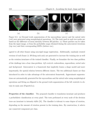 118 Chapter 6. Localising the heart, lungs and liver
(a) (b) (c)
Figure 6.3: (a) Ground truth segmentation of the myocardium (green) and the mitral valve
(red) were generated using morphological operations. (b) The tests used at each tree nodes are
based on the diﬀerence of mean intensity between 3D patches. (c) These patches can be taken
from the input image, or from the probability maps obtained during the autocontext iterations
(top row) and their corresponding GDTs (bottom row).
agated to all other frames using non-rigid image registration. Additionally, randomly rotated
versions of each frame (± 30°along each axis) are generated to increase the training size as well
as the rotation invariance of the trained classiﬁer. Finally, we formulate the two class problem
of the challenge into a four class problem: left ventricle endocardium, myocardium, mitral valve
and background. Autocontext is a framework that implicitly learns a shape model and more
importantly, the spatial relation between diﬀerent classes. The two additional classes are thus
introduced in order to take advantage of the autocontext framework. Approximate segmenta-
tions are automatically generated for the myocardium and the mitral valve using morphological
operations and ﬁtting an ellipsoid to the ground truth segmentation of the left ventricle to ob-
tain its main axis (Figure6.3.a).
Properties of the classiﬁer: The proposed classiﬁer is translation invariant and produces
a probabilistic classiﬁcation at every pixel. The tests performed at every node of the decision
trees are invariant to intensity shifts [31]. The classiﬁer is tolerant to some degree of rotation,
depending on the amount of rotation present in the training data. By construction, it selects
one connected component per class.
 