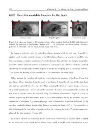 122 Chapter 6. Localising the heart, lungs and liver
6.3.2 Detecting candidate locations for the heart
u0u0
v0v0
w0w0
liverliver
Coronal plane
u0u0
w0w0
v0v0
brainbrain
heartheart
Sagittal plane
v0v0
w0w0
u0u0
heartheart
rightright
lunglung
Transverse plane
Figure 6.5: Average image of 30 healthy fetuses after resizing (Section 6.3.1) and alignment
deﬁned by anatomical landmarks (Section 6.3.2). It highlights the characteristic intensity
patterns in fetal MRI for the brain, heart, lungs and liver.
In theory, a detector could be trained on aligned images, while at test time, it would be
applied to all possible rotated versions of the 3D volume. However, in practice it would be too
time consuming to explore an exhaustive set of rotations. In particular, the integral image that
is used to extract intensity features would need to be computed for all tested rotations. Instead
of rotating the image itself, we thus propose to rotate the sampling grid of the image features.
This is done by deﬁning a local orientation of the 3D volume for every voxel.
When training the classiﬁer, all voxels are oriented using the anatomy of the fetus (Figure 6.5
and Figure 6.6.a): u0 points from the heart to the brain, v0 from the left lung to the right lung
and w0 from back to front (w0 = u0×v0). When applying the detector to a new image, in theory,
all possible orientations (u, v, w) should be explored. However, assuming that the location of
the brain is already known, for instance using the detector presented in Chapter 4, u can be
deﬁned as pointing from the current voxel x to the brain (Figure 6.6.b). In this case, only the
orientation of the plane Px,u passing through x and orthogonal to u remains undeﬁned. (v, w)
are then randomly chosen so that they form an orthonormal basis of Px,u. The rationale for
this deﬁnition of u is that when x is positioned at the center of the heart, Px,u is the transverse
plane of the fetal anatomy (Figure 6.5).
In order to address the sensitivity to the localisation of the brain, a random oﬀset is added
to the estimated brain center with a 10mm range, which is in the order of magnitude of the
 