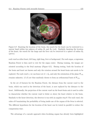 6.3. Random Forests with steerable features 125
R1R1
R2R2
R
3
R
3
Figure 6.7: Knowing the location of the brain, the search for the heart can be restricted to a
narrow band within two spheres of radius R1 and R2 (red). Similarly, knowing the location
of the heart, the search for the lungs and the liver can be restricted to a sphere of radius R3
(green).
each voxel as either heart, left lung, right lung, liver or background. For each organ, a regression
Random Forest is then used to vote for the organ center. During training, the images are
oriented according to the fetal anatomy (Figure 6.5). During testing, both the location of
the brain and heart are known and only the rotation around the heart-brain axis needs to be
explored. For each voxel x, we can hence set u = u0, and only the orientation of the plane Px,u0
remains unknown. (v, w) are thus randomly chosen to form an orthonormal basis of Px,u0 .
In the set of features for the Random Forest, the distance from the current voxel to the
brain, which was used in the detection of the heart, is now replaced by the distance to the
heart. Additionally, the projection of the current voxel on the heart-brain axis is used in order
to characterise whether the current voxel is below or above the heart relative to the brain.
Similarly to the heart detection, the detector is run with an angular step θ. For each voxel, the
value of θ maximizing the probability of being inside one of the organs of the fetus is selected.
The diﬀerent hypotheses for the location of the heart can be tested in parallel to reduce the
computation time.
The advantage of a cascade approach when localising organs has already been highlighted
 