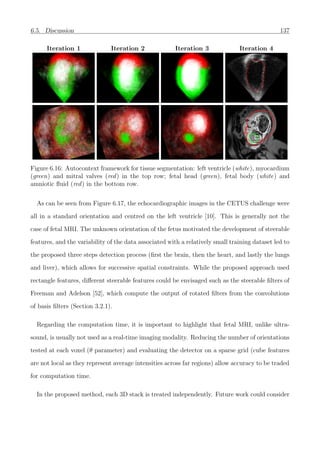 6.5. Discussion 137
Iteration 1 Iteration 2 Iteration 3 Iteration 4
Figure 6.16: Autocontext framework for tissue segmentation: left ventricle (white), myocardium
(green) and mitral valves (red) in the top row; fetal head (green), fetal body (white) and
amniotic ﬂuid (red) in the bottom row.
As can be seen from Figure 6.17, the echocardiographic images in the CETUS challenge were
all in a standard orientation and centred on the left ventricle [10]. This is generally not the
case of fetal MRI. The unknown orientation of the fetus motivated the development of steerable
features, and the variability of the data associated with a relatively small training dataset led to
the proposed three steps detection process (ﬁrst the brain, then the heart, and lastly the lungs
and liver), which allows for successive spatial constraints. While the proposed approach used
rectangle features, diﬀerent steerable features could be envisaged such as the steerable ﬁlters of
Freeman and Adelson [52], which compute the output of rotated ﬁlters from the convolutions
of basis ﬁlters (Section 3.2.1).
Regarding the computation time, it is important to highlight that fetal MRI, unlike ultra-
sound, is usually not used as a real-time imaging modality. Reducing the number of orientations
tested at each voxel (θ parameter) and evaluating the detector on a sparse grid (cube features
are not local as they represent average intensities across far regions) allow accuracy to be traded
for computation time.
In the proposed method, each 3D stack is treated independently. Future work could consider
 