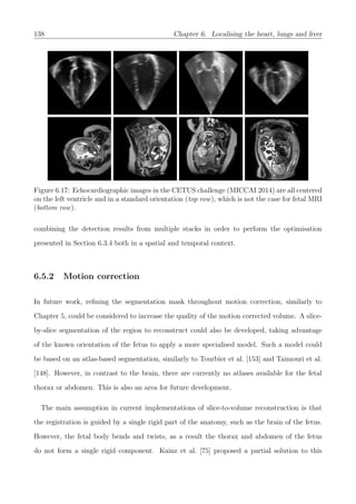 138 Chapter 6. Localising the heart, lungs and liver
Figure 6.17: Echocardiographic images in the CETUS challenge (MICCAI 2014) are all centered
on the left ventricle and in a standard orientation (top row), which is not the case for fetal MRI
(bottom row).
combining the detection results from multiple stacks in order to perform the optimisation
presented in Section 6.3.4 both in a spatial and temporal context.
6.5.2 Motion correction
In future work, reﬁning the segmentation mask throughout motion correction, similarly to
Chapter 5, could be considered to increase the quality of the motion corrected volume. A slice-
by-slice segmentation of the region to reconstruct could also be developed, taking advantage
of the known orientation of the fetus to apply a more specialised model. Such a model could
be based on an atlas-based segmentation, similarly to Tourbier et al. [153] and Taimouri et al.
[148]. However, in contrast to the brain, there are currently no atlases available for the fetal
thorax or abdomen. This is also an area for future development.
The main assumption in current implementations of slice-to-volume reconstruction is that
the registration is guided by a single rigid part of the anatomy, such as the brain of the fetus.
However, the fetal body bends and twists, as a result the thorax and abdomen of the fetus
do not form a single rigid component. Kainz et al. [75] proposed a partial solution to this
 