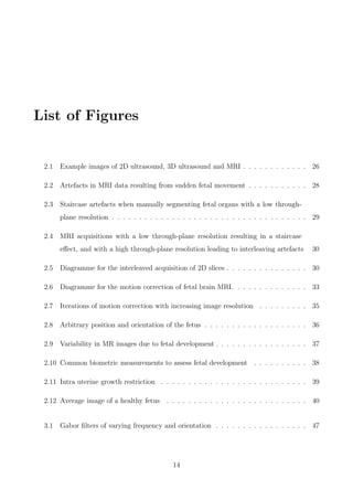 List of Figures
2.1 Example images of 2D ultrasound, 3D ultrasound and MRI . . . . . . . . . . . . 26
2.2 Artefacts in MRI data resulting from sudden fetal movement . . . . . . . . . . . 28
2.3 Staircase artefacts when manually segmenting fetal organs with a low through-
plane resolution . . . . . . . . . . . . . . . . . . . . . . . . . . . . . . . . . . . . 29
2.4 MRI acquisitions with a low through-plane resolution resulting in a staircase
eﬀect, and with a high through-plane resolution leading to interleaving artefacts 30
2.5 Diagramme for the interleaved acquisition of 2D slices . . . . . . . . . . . . . . . 30
2.6 Diagramme for the motion correction of fetal brain MRI. . . . . . . . . . . . . . 33
2.7 Iterations of motion correction with increasing image resolution . . . . . . . . . 35
2.8 Arbitrary position and orientation of the fetus . . . . . . . . . . . . . . . . . . . 36
2.9 Variability in MR images due to fetal development . . . . . . . . . . . . . . . . . 37
2.10 Common biometric measurements to assess fetal development . . . . . . . . . . 38
2.11 Intra uterine growth restriction . . . . . . . . . . . . . . . . . . . . . . . . . . . 39
2.12 Average image of a healthy fetus . . . . . . . . . . . . . . . . . . . . . . . . . . 40
3.1 Gabor ﬁlters of varying frequency and orientation . . . . . . . . . . . . . . . . . 47
14
 
