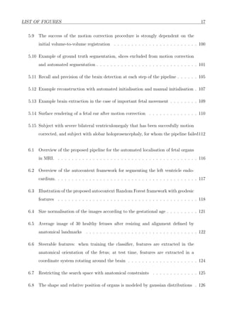 LIST OF FIGURES 17
5.9 The success of the motion correction procedure is strongly dependent on the
initial volume-to-volume registration . . . . . . . . . . . . . . . . . . . . . . . . 100
5.10 Example of ground truth segmentation, slices excluded from motion correction
and automated segmentation . . . . . . . . . . . . . . . . . . . . . . . . . . . . . 101
5.11 Recall and precision of the brain detection at each step of the pipeline . . . . . . 105
5.12 Example reconstruction with automated initialisation and manual initialisation . 107
5.13 Example brain extraction in the case of important fetal movement . . . . . . . . 109
5.14 Surface rendering of a fetal ear after motion correction . . . . . . . . . . . . . . 110
5.15 Subject with severe bilateral ventriculomegaly that has been succesfully motion
corrected, and subject with alobar holoprosencephaly, for whom the pipeline failed112
6.1 Overview of the proposed pipeline for the automated localisation of fetal organs
in MRI. . . . . . . . . . . . . . . . . . . . . . . . . . . . . . . . . . . . . . . . . 116
6.2 Overview of the autocontext framework for segmenting the left ventricle endo-
cardium. . . . . . . . . . . . . . . . . . . . . . . . . . . . . . . . . . . . . . . . . 117
6.3 Illustration of the proposed autocontext Random Forest framework with geodesic
features . . . . . . . . . . . . . . . . . . . . . . . . . . . . . . . . . . . . . . . . 118
6.4 Size normalisation of the images according to the gestational age . . . . . . . . . 121
6.5 Average image of 30 healthy fetuses after resizing and alignment deﬁned by
anatomical landmarks . . . . . . . . . . . . . . . . . . . . . . . . . . . . . . . . 122
6.6 Steerable features: when training the classiﬁer, features are extracted in the
anatomical orientation of the fetus; at test time, features are extracted in a
coordinate system rotating around the brain . . . . . . . . . . . . . . . . . . . . 124
6.7 Restricting the search space with anatomical constraints . . . . . . . . . . . . . 125
6.8 The shape and relative position of organs is modeled by gaussian distributions . 126
 