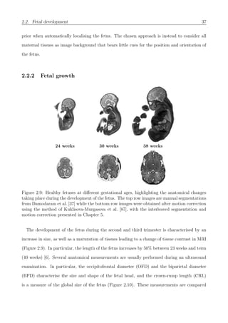 2.2. Fetal development 37
prior when automatically localising the fetus. The chosen approach is instead to consider all
maternal tissues as image background that bears little cues for the position and orientation of
the fetus.
2.2.2 Fetal growth
24 weeks 30 weeks 38 weeks
Figure 2.9: Healthy fetuses at diﬀerent gestational ages, highlighting the anatomical changes
taking place during the development of the fetus. The top row images are manual segmentations
from Damodaram et al. [37] while the bottom row images were obtained after motion correction
using the method of Kuklisova-Murgasova et al. [87], with the interleaved segmentation and
motion correction presented in Chapter 5.
The development of the fetus during the second and third trimester is characterised by an
increase in size, as well as a maturation of tissues leading to a change of tissue contrast in MRI
(Figure 2.9). In particular, the length of the fetus increases by 50% between 23 weeks and term
(40 weeks) [6]. Several anatomical measurements are usually performed during an ultrasound
examination. In particular, the occipitofrontal diameter (OFD) and the biparietal diameter
(BPD) characterise the size and shape of the fetal head, and the crown-rump length (CRL)
is a measure of the global size of the fetus (Figure 2.10). These measurements are compared
 