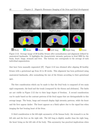 40 Chapter 2. Magnetic Resonance Imaging of the fetus and fetal development
stomachstomach
liverliver
Coronal plane
brainbrain
heartheart
Sagittal plane
heartheart
rightright
lunglung
Transverse plane
Body Brain Heart Left lung Right lung Liver
Figure 2.12: Average image of 30 healthy fetuses after normalisation and alignment deﬁned by
anatomical landmarks. It highlights the characteristic intensity patterns in fetal MRI for the
brain, heart, lungs, stomach and liver. The bottom row corresponds to the average of each
individual segmentation.
that have been manually segmented [37]. Figure 2.12 was obtained after aligning 30 healthy
fetuses with a gestational age from 24 to 38 weeks. This alignment has been performed using
anatomical landmarks, after normalising the size of the fetuses according to their gestational
ages.
The ﬁrst consideration which can be made is that the fetal body is composed of two main
rigid components, the head and the trunk (composed by the thorax and abdomen). The limbs
are not visible in Figure 2.12 due to their large degree of freedom. A second consideration
can be made based on the contrast patterns of the fetal organs that are distinguishable in this
average image. The brain, lungs and stomach display high intensity patterns, while the heart
and the liver appear darker. The heart appears as a black sphere due to the signal loss when
imaging the fast beating heart of the fetus.
A third consideration is the left-right asymmetry of the human body: the stomach is on the
left side and the liver on the right side. The left lung is slightly smaller than the right lung,
the heart being on the left side of the body. This asymmetry has practical implications when
 