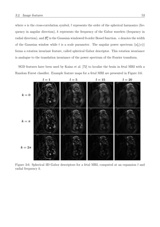 3.2. Image features 53
where is the cross-correlation symbol, l represents the order of the spherical harmonics (fre-
quency in angular direction), k represents the frequency of the Gabor wavelets (frequency in
radial direction), and B0
s is the Gaussian windowed 0-order Bessel function. s denotes the width
of the Gaussian window while t is a scale parameter. The angular power spectrum ||al
k(x)||
forms a rotation invariant feature, called spherical Gabor descriptor. This rotation invariance
is analogue to the translation invariance of the power spectrum of the Fourier transform.
SGD features have been used by Kainz et al. [72] to localise the brain in fetal MRI with a
Random Forest classiﬁer. Example feature maps for a fetal MRI are presented in Figure 3.6.
l = 1 l = 5 l = 15 l = 20
k = 0
k = π
k = 2π
Figure 3.6: Spherical 3D Gabor descriptors for a fetal MRI, computed at an expansion l and
radial frequency k.
 