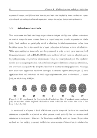 64 Chapter 3. Machine learning and object detection
segmented images, and (2) machine learning methods that implicitly learn an abstract repre-
sentation of a training database of segmented images through a feature extraction step.
3.5.1 Atlas-based methods
Most atlas-based methods use image registration techniques to align and deform a template
or a set of images in order to map them to a target image and transfer segmentation labels
[158]. Such methods are principally aimed at obtaining detailed segmentations rather than
localising organs due to the sensitivity of most registration techniques to their initialisation.
While some registration frameworks have been proposed in order to carry out a large search of
the parameter space, such as FSL-FLIRT [70], most methods will only carry out a limited search
to avoid converging toward a local minimum and reduce the computational cost. The similarity
metrics used in image registration, such as the sum of squared diﬀerences or mutual information,
can be seen as analogous to the image features used in machine learning approaches. Although
most atlas-based approaches have been developed in order to segment brain images [3], such
approaches have also been used for multi-organ segmentations, such as abdominal CT scans
[168], or whole body MRI [46].
23 25 27 29 31 33 35 37
Figure 3.12: T2 templates of the developing fetal brain from 23 to 37 weeks of gestational ages
[135] are matched to the acquired MR scans in order to localise and extract the brain of the
fetus [148, 149, 153].
As mentioned in Chapter 2, fetal MRI do not provide images of the fetus in a standard
orientation comparable to scans of an adult patient, which generally lies in a conventional
orientation in the scanner. Moreover, the fetus is surrounded by maternal tissues. Registration
methods are thus unlikely to succeed for the fetus, unless a region of interest has been isolated as
 