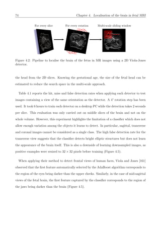 74 Chapter 4. Localisation of the brain in fetal MRI
For every slice For every rotation Multi-scale sliding window
Figure 4.2: Pipeline to localise the brain of the fetus in MR images using a 2D Viola-Jones
detector.
the head from the 2D slices. Knowing the gestational age, the size of the fetal head can be
estimated to reduce the search space in the multi-scale approach.
Table 4.1 reports the hit, miss and false detection rates when applying each detector to test
images containing a view of the same orientation as the detector. A 4° rotation step has been
used. It took 6 hours to train each detector on a desktop PC while the detection takes 2 seconds
per slice. This evaluation was only carried out on middle slices of the brain and not on the
whole volume. However, this experiment highlights the limitation of a classiﬁer which does not
allow enough variation among the objects it learns to detect. In particular, sagittal, transverse
and coronal images cannot be considered as a single class. The high false detection rate for the
transverse view suggests that the classiﬁer detects bright elliptic structures but does not learn
the appearance of the brain itself. This is also a downside of learning downsampled images, as
positive examples were resized to 32 × 32 pixels before training (Figure 4.5).
When applying their method to detect frontal views of human faces, Viola and Jones [161]
observed that the ﬁrst feature automatically selected by the AdaBoost algorithm corresponds to
the region of the eyes being darker than the upper cheeks. Similarly, in the case of mid-sagittal
views of the fetal brain, the ﬁrst feature captured by the classiﬁer corresponds to the region of
the jaws being darker than the brain (Figure 4.5).
 