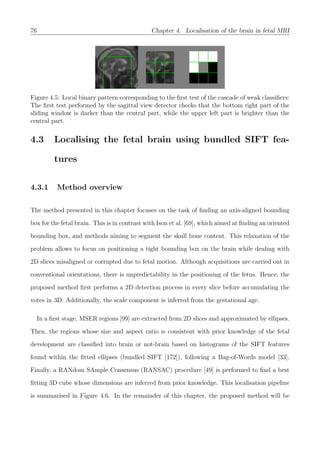 76 Chapter 4. Localisation of the brain in fetal MRI
Figure 4.5: Local binary pattern corresponding to the ﬁrst test of the cascade of weak classiﬁers:
The ﬁrst test performed by the sagittal view detector checks that the bottom right part of the
sliding window is darker than the central part, while the upper left part is brighter than the
central part.
4.3 Localising the fetal brain using bundled SIFT fea-
tures
4.3.1 Method overview
The method presented in this chapter focuses on the task of ﬁnding an axis-aligned bounding
box for the fetal brain. This is in contrast with Ison et al. [69], which aimed at ﬁnding an oriented
bounding box, and methods aiming to segment the skull bone content. This relaxation of the
problem allows to focus on positioning a tight bounding box on the brain while dealing with
2D slices misaligned or corrupted due to fetal motion. Although acquisitions are carried out in
conventional orientations, there is unpredictability in the positioning of the fetus. Hence, the
proposed method ﬁrst performs a 2D detection process in every slice before accumulating the
votes in 3D. Additionally, the scale component is inferred from the gestational age.
In a ﬁrst stage, MSER regions [99] are extracted from 2D slices and approximated by ellipses.
Then, the regions whose size and aspect ratio is consistent with prior knowledge of the fetal
development are classiﬁed into brain or not-brain based on histograms of the SIFT features
found within the ﬁtted ellipses (bundled SIFT [172]), following a Bag-of-Words model [33].
Finally, a RANdom SAmple Consensus (RANSAC) procedure [49] is performed to ﬁnd a best
ﬁtting 3D cube whose dimensions are inferred from prior knowledge. This localisation pipeline
is summarised in Figure 4.6. In the remainder of this chapter, the proposed method will be
 