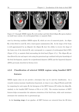 78 Chapter 4. Localisation of the brain in fetal MRI
(a) (b) (c)
Figure 4.7: Example MSER regions Ri (red overlay) and their ﬁtted ellipses Ei (green dashes):
(a) skull bone content, (b) cerebrospinal ﬂuid, (c) amniotic ﬂuid.
start by detecting candidate MSER regions Ri which are sets of connected pixels. An ellipse
Ei is then ﬁtted to each Ri with a least-squares minimization [50]. As the shape of the brain
is well approximated by an ellipsoid, the ellipses Ei have the ability to recover the shape of
the brain even if the detected Ri only corresponds to a segment of cerebrospinal ﬂuid (CSF)
(Figure 4.7.b), or amniotic ﬂuid surrounding the fetal head (Figure 4.7.c). The ellipses Ei are
then ﬁltered by size and aspect ratio using the gestational age combined with prior knowledge of
the fetal development, namely the occipitofrontal diameter (OFD) and the biparietal diameter
(BPD) previously described in Section 2.2.2.
4.3.3 Classiﬁcation of selected MSER regions using bundled SIFT
features
MSER regions alone do not provide a descriptor that can be used for classiﬁcation. As a
versatile rotation invariant classiﬁcation framework, we chose to use a Bag-of-Words model [33]
by computing for each region Ri the histogram of the SIFT features [97] within the ellipse Ei,
similarly to the bundled SIFT features of Wu et al. [172]. The rotation invariance of SIFT
features helps accommodate the unknown orientation of the fetal brain, while scale invariance
attenuates the variations due to gestational age.
In the learning stage of our pipeline, all SIFT features are extracted from the 2D slices
 