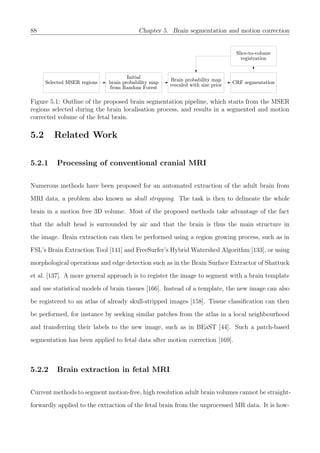 88 Chapter 5. Brain segmentation and motion correction
Figure 5.1: Outline of the proposed brain segmentation pipeline, which starts from the MSER
regions selected during the brain localisation process, and results in a segmented and motion
corrected volume of the fetal brain.
5.2 Related Work
5.2.1 Processing of conventional cranial MRI
Numerous methods have been proposed for an automated extraction of the adult brain from
MRI data, a problem also known as skull stripping. The task is then to delineate the whole
brain in a motion free 3D volume. Most of the proposed methods take advantage of the fact
that the adult head is surrounded by air and that the brain is thus the main structure in
the image. Brain extraction can then be performed using a region growing process, such as in
FSL’s Brain Extraction Tool [141] and FreeSurfer’s Hybrid Watershed Algorithm [133], or using
morphological operations and edge detection such as in the Brain Surface Extractor of Shattuck
et al. [137]. A more general approach is to register the image to segment with a brain template
and use statistical models of brain tissues [166]. Instead of a template, the new image can also
be registered to an atlas of already skull-stripped images [158]. Tissue classiﬁcation can then
be performed, for instance by seeking similar patches from the atlas in a local neighbourhood
and transferring their labels to the new image, such as in BEaST [44]. Such a patch-based
segmentation has been applied to fetal data after motion correction [169].
5.2.2 Brain extraction in fetal MRI
Current methods to segment motion-free, high resolution adult brain volumes cannot be straight-
forwardly applied to the extraction of the fetal brain from the unprocessed MR data. It is how-
 