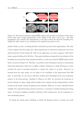 5.3. Method 91
(a)
(b)
Figure 5.2: The brain localisation using MSER regions only provides an estimate of the center
of the brain and a rough segmentation of the middle of the brain (red in (a)). The label
propagation step extends this segmentation to all slices within the detected bounding box,
adding the white region in (a), resulting in the masked brain shown in (b).
patches within an atlas, a training database with known ground truth segmentation. The atlas
is hence aligned with the image and a ﬁnal segmentation is obtained by fusing the votes from
selected patches of atlas images [28, 123]. In our application, we seek to segment a 3D volume
using a sparse labelling of its 2D slices. This sparse labelling corresponds to the periphery of the
bounding box around the brain (background label), as well as the selected MSER regions (brain
label), as shown in Figure 5.3. Therefore, we perform online learning in contrast to conventional
atlas based approaches, which rely on oﬄine training. Working on a single 3D image at a time
excludes the need to normalise intensities or register the volume to an atlas. Moreover, by
learning from the same image, we can adapt to the variability of the unprocessed fetal MR
data. In particular, we can work on 2D slices without prior knowledge of the scan orientation
relative to the fetal anatomy. Similarly to Wang et al. [165], we overcome the restriction of
search windows by using a single global classiﬁer that compares patches independently of their
location in the image, instead of applying local classiﬁers. However, we chose a Random Forest
classiﬁer [15], using 2D intensity patches as features, to maintain a feasible training and testing
speed. A k-nearest neighbour classiﬁer would have little training time, but its evaluation is a
time-consuming process.
To obtain the initial sparse labelling on which the Random Forest is trained, the mask
 
