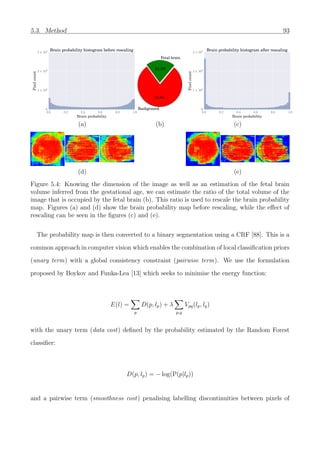 5.3. Method 93
0.0 0.2 0.4 0.6 0.8 1.0
Brain probability
0
1 × 105
2 × 105
3 × 105
Pixelcount
Brain probability histogram before rescaling
Fetal brain
21.2%
Background
78.8%
0.0 0.2 0.4 0.6 0.8 1.0
Brain probability
0
1 × 105
2 × 105
3 × 105
Pixelcount
Brain probability histogram after rescaling
(a) (b) (c)
(d) (e)
Figure 5.4: Knowing the dimension of the image as well as an estimation of the fetal brain
volume inferred from the gestational age, we can estimate the ratio of the total volume of the
image that is occupied by the fetal brain (b). This ratio is used to rescale the brain probability
map. Figures (a) and (d) show the brain probability map before rescaling, while the eﬀect of
rescaling can be seen in the ﬁgures (c) and (e).
The probability map is then converted to a binary segmentation using a CRF [88]. This is a
common approach in computer vision which enables the combination of local classiﬁcation priors
(unary term) with a global consistency constraint (pairwise term). We use the formulation
proposed by Boykov and Funka-Lea [13] which seeks to minimise the energy function:
E(l) =
p
D(p, lp) + λ
p,q
Vpq(lp, lq)
with the unary term (data cost) deﬁned by the probability estimated by the Random Forest
classiﬁer:
D(p, lp) = − log(P(p|lp))
and a pairwise term (smoothness cost) penalising labelling discontinuities between pixels of
 