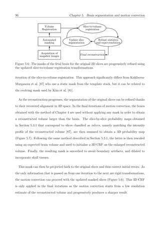 96 Chapter 5. Brain segmentation and motion correction
Figure 5.6: The masks of the fetal brain for the original 2D slices are progressively reﬁned using
the updated slice-to-volume registration transformations.
iteration of the slice-to-volume registration. This approach signiﬁcantly diﬀers from Kuklisova-
Murgasova et al. [87] who use a static mask from the template stack, but it can be related to
the evolving mask used by Kim et al. [81].
As the reconstruction progresses, the segmentation of the original slices can be reﬁned thanks
to their recovered alignment in 3D space. In the ﬁnal iterations of motion correction, the boxes
obtained with the method of Chapter 4 are used without applying any mask in order to obtain
a reconstructed volume larger than the brain. The slice-by-slice probability maps obtained
in Section 5.3.1 that correspond to slices classiﬁed as inliers, namely matching the intensity
proﬁle of the reconstructed volume [87], are then summed to obtain a 3D probability map
(Figure 5.7). Following the same method described in Section 5.3.1, the latter is then rescaled
using an expected brain volume and used to initialise a 3D CRF on the enlarged reconstructed
volume. Finally, the resulting mask is smoothed to avoid boundary artefacts, and dilated to
incorporate skull tissues.
This mask can then be projected back to the original slices and thus correct initial errors. As
the only information that is passed on from one iteration to the next are rigid transformations,
the motion correction can proceed with the updated masked slices (Figure 5.6). This 3D CRF
is only applied in the ﬁnal iterations as the motion correction starts from a low resolution
estimate of the reconstructed volume and progressively produces a sharper result.
 