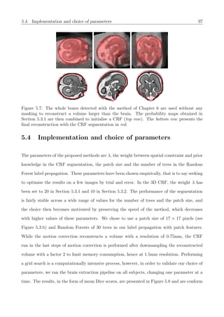5.4. Implementation and choice of parameters 97
Figure 5.7: The whole boxes detected with the method of Chapter 6 are used without any
masking to reconstruct a volume larger than the brain. The probability maps obtained in
Section 5.3.1 are then combined to initialise a CRF (top row). The bottom row presents the
ﬁnal reconstruction with the CRF segmentation in red.
5.4 Implementation and choice of parameters
The parameters of the proposed methods are λ, the weight between spatial constraint and prior
knowledge in the CRF segmentation, the patch size and the number of trees in the Random
Forest label propagation. These parameters have been chosen empirically, that is to say seeking
to optimise the results on a few images by trial and error. In the 3D CRF, the weight λ has
been set to 20 in Section 5.3.1 and 10 in Section 5.3.2. The performance of the segmentation
is fairly stable across a wide range of values for the number of trees and the patch size, and
the choice then becomes motivated by preserving the speed of the method, which decreases
with higher values of these parameters. We chose to use a patch size of 17 × 17 pixels (see
Figure 5.3.b) and Random Forests of 30 trees in our label propagation with patch features.
While the motion correction reconstructs a volume with a resolution of 0.75mm, the CRF
run in the last steps of motion correction is performed after downsampling the reconstructed
volume with a factor 2 to limit memory consumption, hence at 1.5mm resolution. Performing
a grid search is a computationally intensive process, however, in order to validate our choice of
parameters, we ran the brain extraction pipeline on all subjects, changing one parameter at a
time. The results, in the form of mean Dice scores, are presented in Figure 5.8 and are conform
 