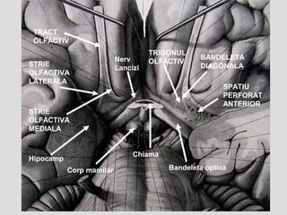 Trigonul Inghinal Atlas de neuroanatomie - cai ascendente | PPT