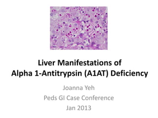 Liver Manifestations of
Alpha 1-Antitrypsin (A1AT) Deficiency
Joanna Yeh
Peds GI Case Conference
Jan 2013
 