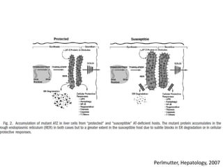 Perlmutter, Hepatology, 2007
 