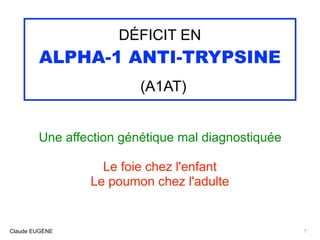 DÉFICIT EN
ALPHA-1 ANTI-TRYPSINE
(A1AT)
Une affection génétique mal diagnostiquée
Le foie chez l'enfant
Le poumon chez l'adulte
1Claude EUGÈNE
 