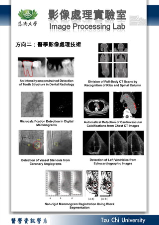 影像處理實驗室 Image Processing Lab ABA’ 方向二：醫學影像處理技術 Non-rigid Mammogram Registration Using Block Segmentation |A-B|           |A’-B|                                                          Automatical Detection of Cardiovascular Calcifications from Chest CT Images Division of Full-Body CT Scans by Recognition of Ribs and Spinal Column An Intensity-unconstrained Detection of Tooth Structure in Dental Radiology Detection of Vessel Stenosisfrom Coronary Angiograms Microcalcification Detection in Digital Mammograms Detection of Left Ventricles from Echocardiographic Images 