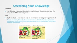 Stretching Your Knowledge
Scenario:
 High Blood pressure can damage the capillaries of the glomerulus and the
epithelium of Bowman’s capsule.
Task:
 Explain why the presence of protein in urine can be a sign of hypertension?
5/17/2015 39
Proteins are normally filtered by the basement membrane. If this has been damaged by high
blood pressure then proteins can enter bowmans capsule from the blood and pass into the urine
presenting as proteinuria
 