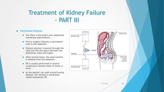 Treatment of Kidney Failure
- PART III
 Peritoneal Dialysis
 The filter is the body’s own abdominal
membrane (peritoneum).
 First a surgeon implants a permanent
tube in the abdomen.
 Dialysis solution is poured through the
tube and fills the space between the
abdominal walls and organs
 After several hours, the used solution
is drained from the abdomen.
 PD is usually performed in several
consecutive sessions daily at home or
work.
 As the patient can walk around having
dialysis, the method is sometimes
called ambulatory PD
5/17/2015 69
 