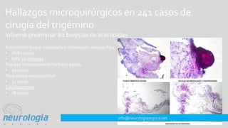 Hallazgos microquirúrgicos en 241 casos de
cirugía del trigémino
Informe preliminar 82 biopsias de aracnoides
Aracnoiditis...