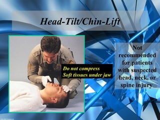 Head-Tilt/Chin-Lift
Do not compress
Soft tissues under jaw
Not
recommended
for patients
with suspected
head, neck, or
spine injury
 