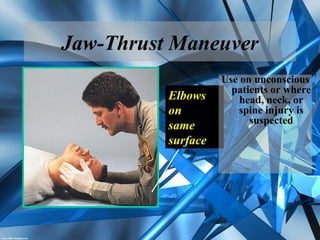 Jaw-Thrust Maneuver
Elbows
on
same
surface
Use on unconscious
patients or where
head, neck, or
spine injury is
suspected
 