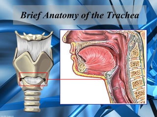 Brief Anatomy of the Trachea
 