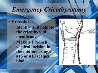 Emergency Cricothyrotomy
• Procedure:
– Identify and palpate
the cricothyroid
membrane
– Make a 1 ½-inch
vertical incision in
the midline using a
#15 or #10 scalpel
blade
 