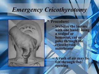 Emergency Cricothyrotomy
 Procedure:
– Stabilize the larynx
with one hand; using
a scalpel or
hemostat, cut or
poke through the
cricothyroid
membrane
– A rush of air may be
felt through the
opening
 