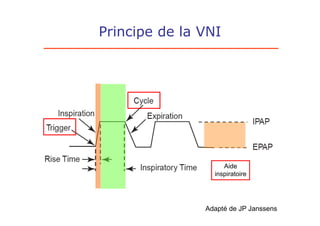 Principe de la VNI




                    Aide
                 inspiratoire




               Adapté de JP Janssens
 