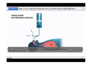 Ventilation Non Invasive
 