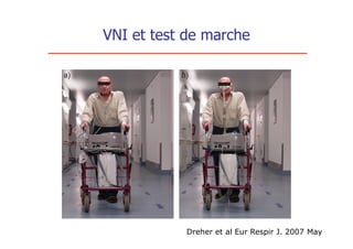 VNI et test de marche




           Dreher et al Eur Respir J. 2007 May
 