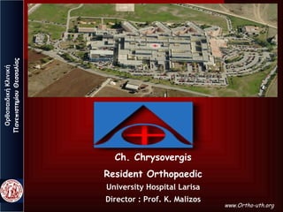 ΟρθοπαιδικήΚλινική
ΠανεπιστημίουΘεσσαλίας
Ch. Chrysovergis
Resident Orthopaedic
University Hospital Larisa
Director : Prof. K. Malizos
www.Ortho-uth.org
 