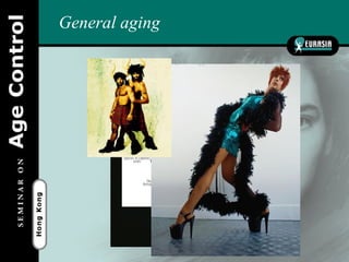 General aging
