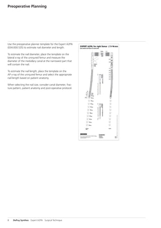 A2FN Synthes dsem trm-1015-0537-1-lr | PDF