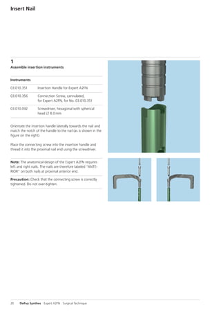 A2FN Synthes dsem trm-1015-0537-1-lr | PDF