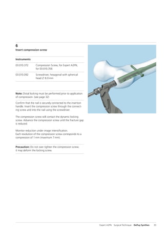 A2FN Synthes dsem trm-1015-0537-1-lr | PDF