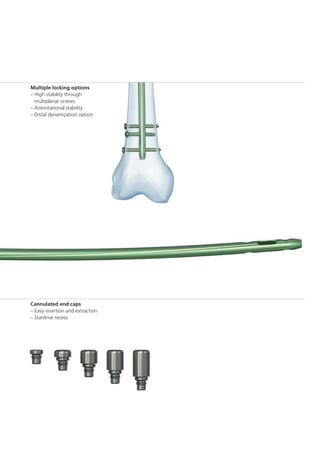 A2FN Synthes dsem trm-1015-0537-1-lr | PDF