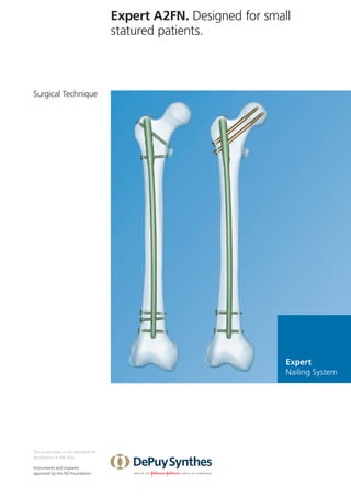 Soft Tissue Bone Reduction Forceps, DePuy Synthes