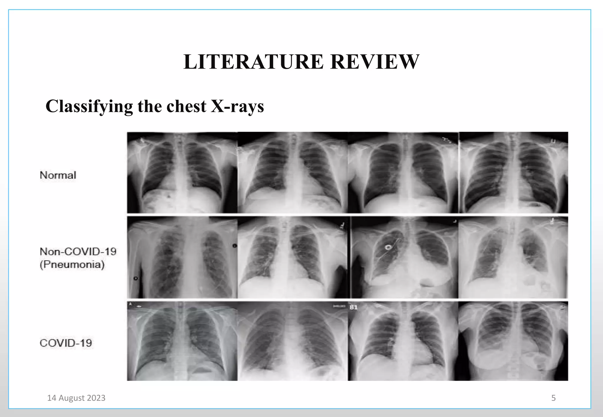covid 19 detection using lung x-rays.pptx.pptx