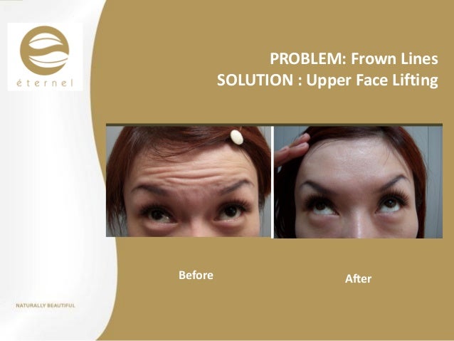 Download The Scar Solution Ebook Free