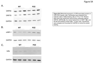 sXBP-1
GAPDH
WT	
   PiZZ	
  
GRP78
WT	
   PiZZ	
  
GAPDH
GRP94
IκBα
GAPDH
WT	
   PiZZ	
  
Figure	
  S4	
  
Figure S4 Differential expression of UPR-associated proteins in
PiZZ iPSC-hepatic cells. Cell lysates were prepared from
triplicate wells of differentiating cells at T16 or T18. Western
blots were then performed using primary antibodies against
GRP78, GRP94 (A), the mature spliced form of XBP-1 (B), and
the NF-κB inhibitory protein IκBα. In each case, membranes
were strippled and re-probed for GAPDH to control for protein
loading.	
  
A.
B.
C.
 