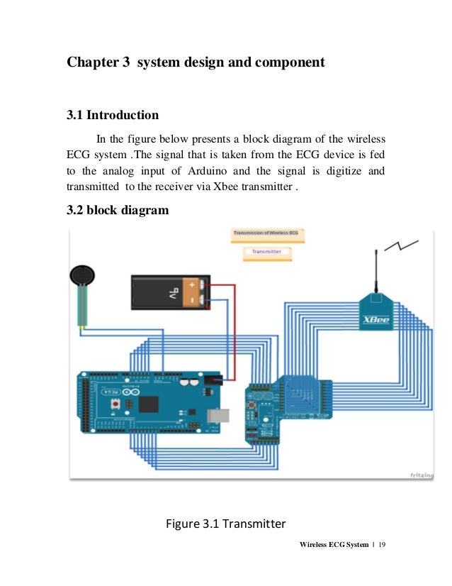 Wireless ECG System