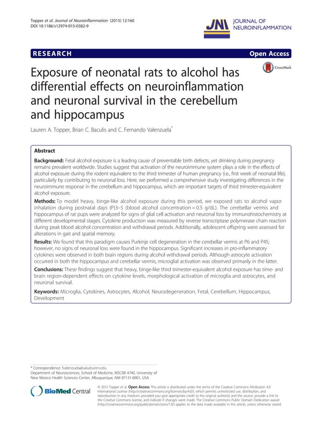 Exposure of neonatal rats to alcohol has differential effects on
