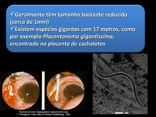 Geralmente têm tamanho bastante reduzidoGeralmente têm tamanho bastante reduzido
(cerca de 1mm)(cerca de 1mm)
Existem espécies gigantes com 17 metros, comoExistem espécies gigantes com 17 metros, como
por exemplopor exemplo Placentonema gigantissima,Placentonema gigantissima,
encontrada na placenta deencontrada na placenta de cachalotescachalotes
 